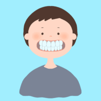 マウスピース矯正