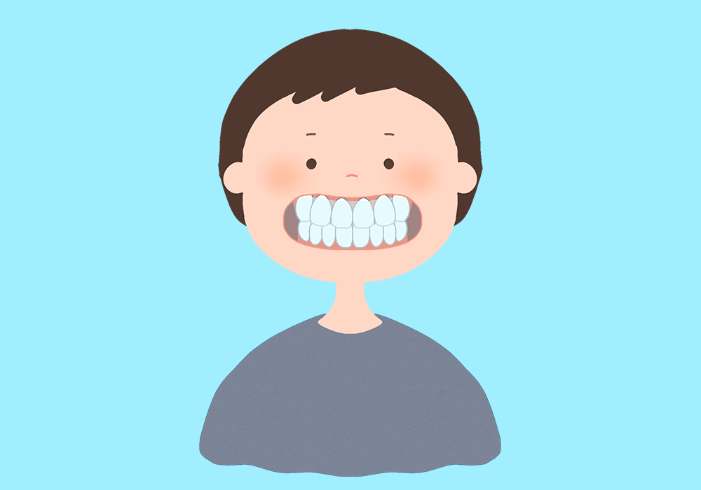 マウスピース矯正