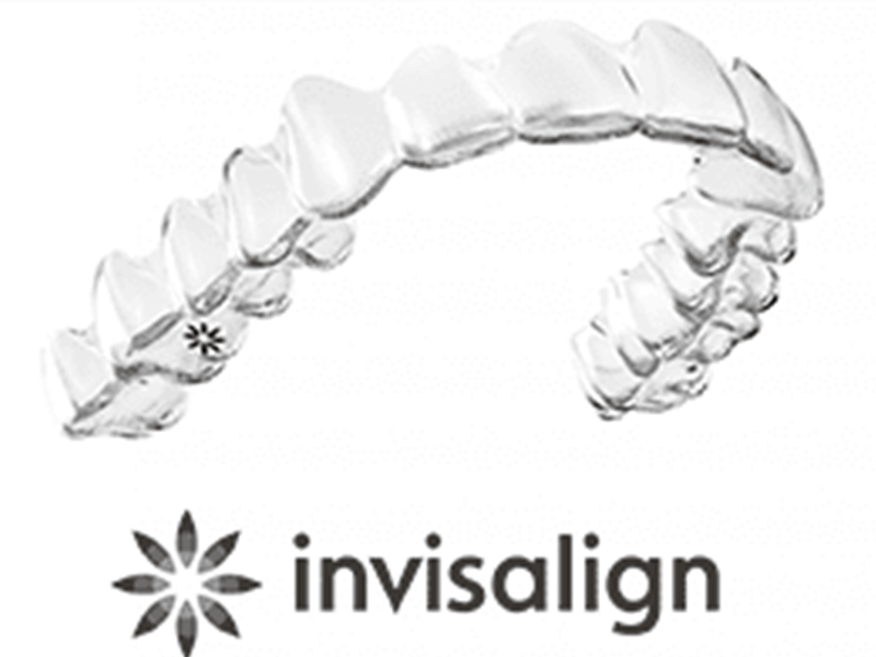 マウスピース矯正