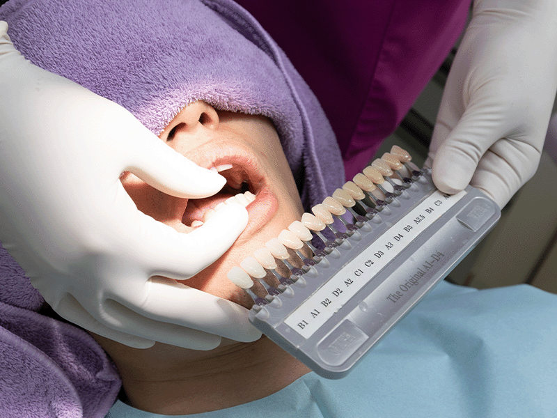 ホワイトニング