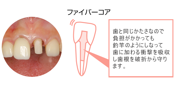 ファイバーコア